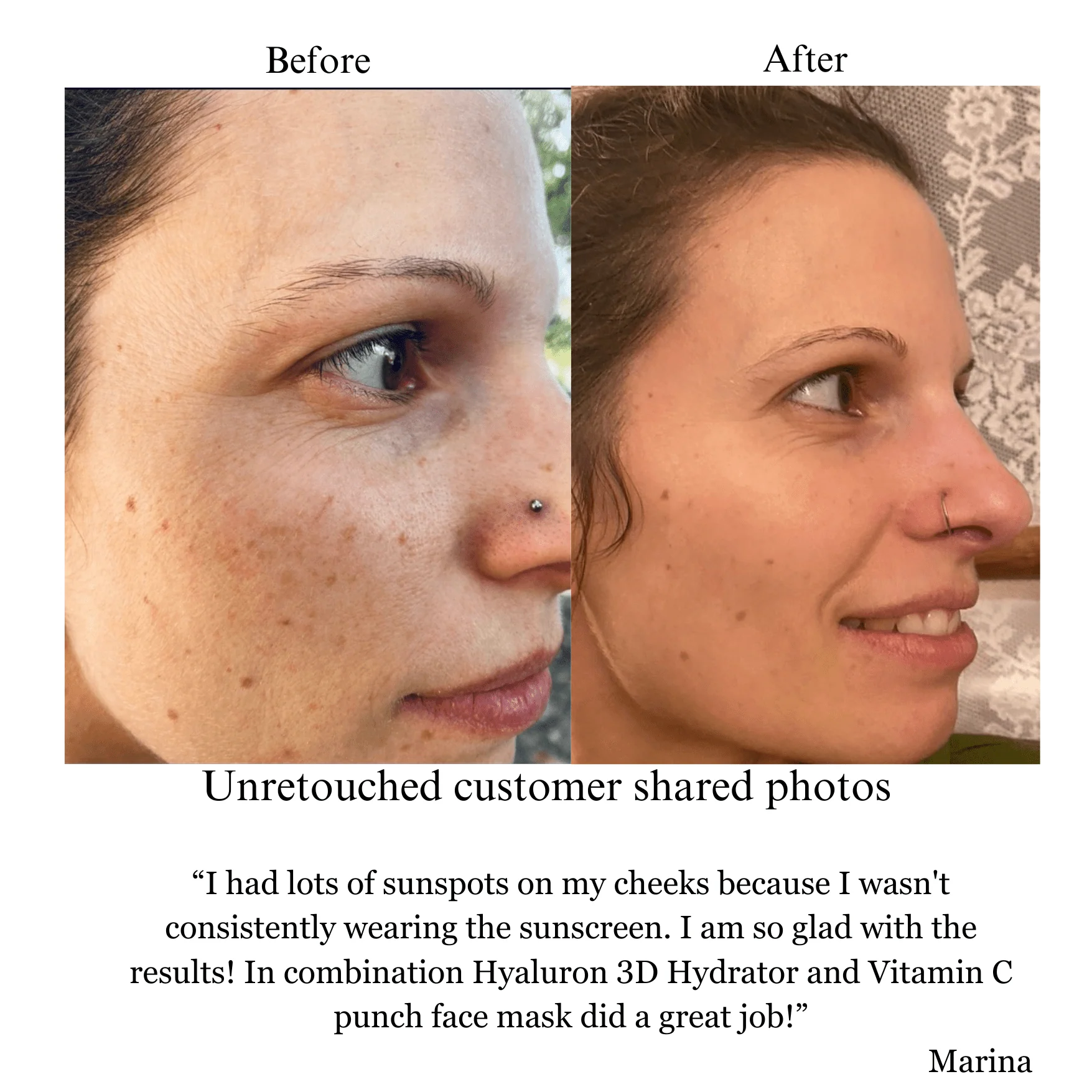 Hyaluron 3D Hydrator Multi Lamellar Emulsion The Advanced Response Face and Neck Cream-Serum with Matrixyl 3000 and Argireline Amplified - Image 3