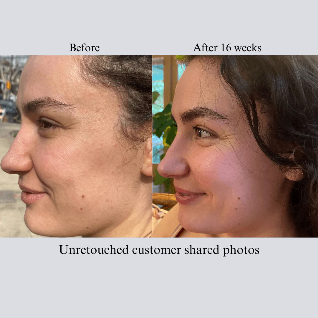 Hyaluron 3D Hydrator Multi Lamellar Emulsion The Advanced Response Face and Neck Cream-Serum with Matrixyl 3000 and Argireline Amplified - Image 4