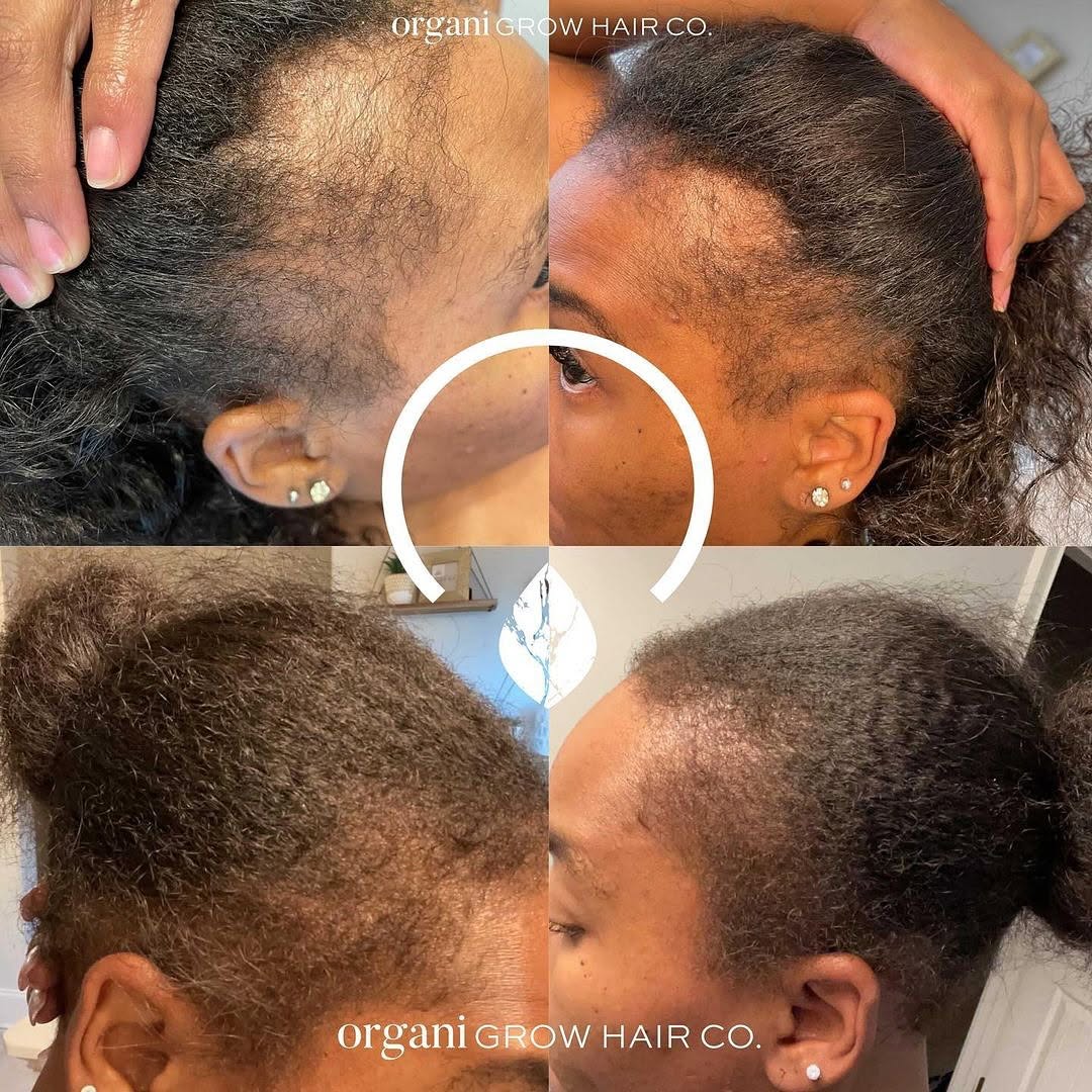 Stimulating Scalp Beverage – High with Black Seed Oil - Hair Growth Oil - Image 3