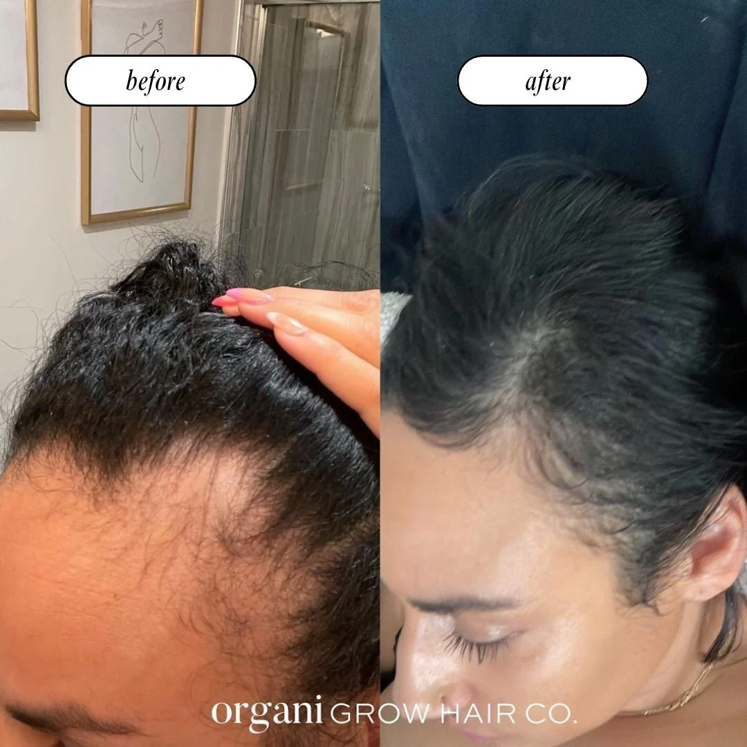 Stimulating Scalp Beverage – High with Black Seed Oil - Hair Growth Oil - Image 7