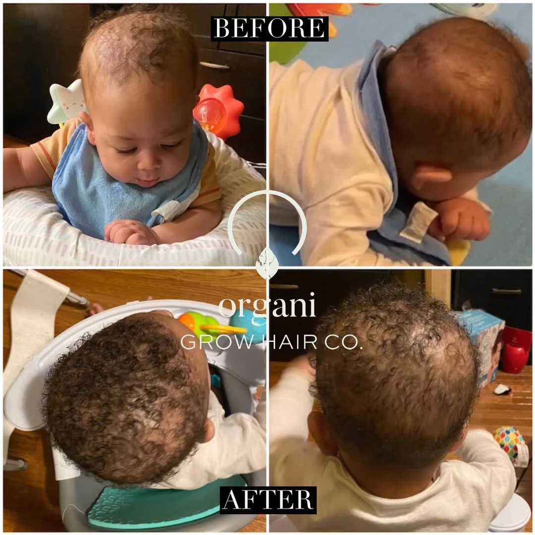 Stimulating Scalp Beverage – High with Black Seed Oil - Hair Growth Oil - Image 9