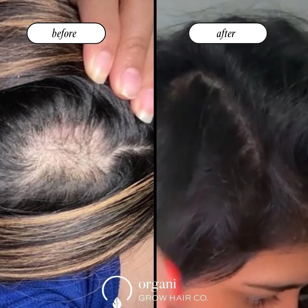 Stimulating Scalp Beverage - Medium Porosity with Black Seed Oil - Hair Growth Oil - Image 2