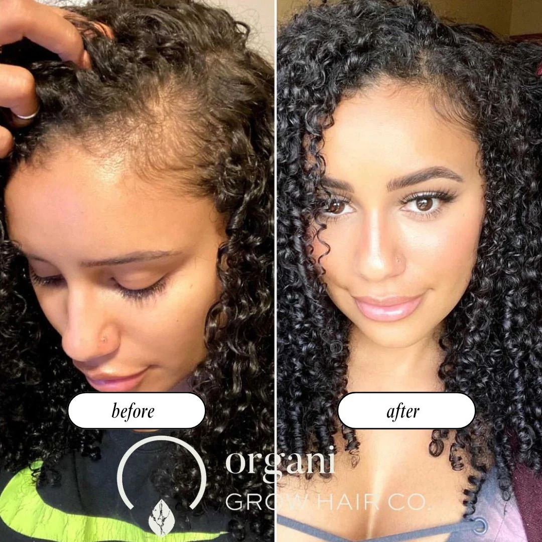 Stimulating Scalp Beverage - Medium Porosity with Black Seed Oil - Hair Growth Oil - Image 4
