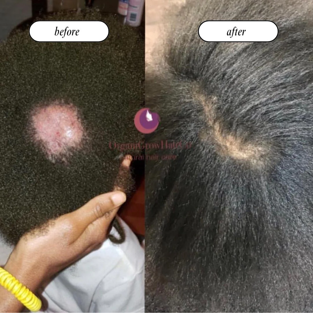 Stimulating Scalp Beverage - Medium Porosity with Black Seed Oil - Hair Growth Oil - Image 5