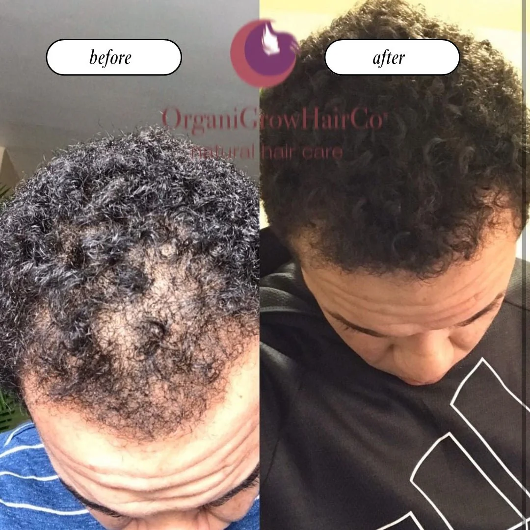 Stimulating Scalp Beverage - Medium Porosity with Black Seed Oil - Hair Growth Oil - Image 6