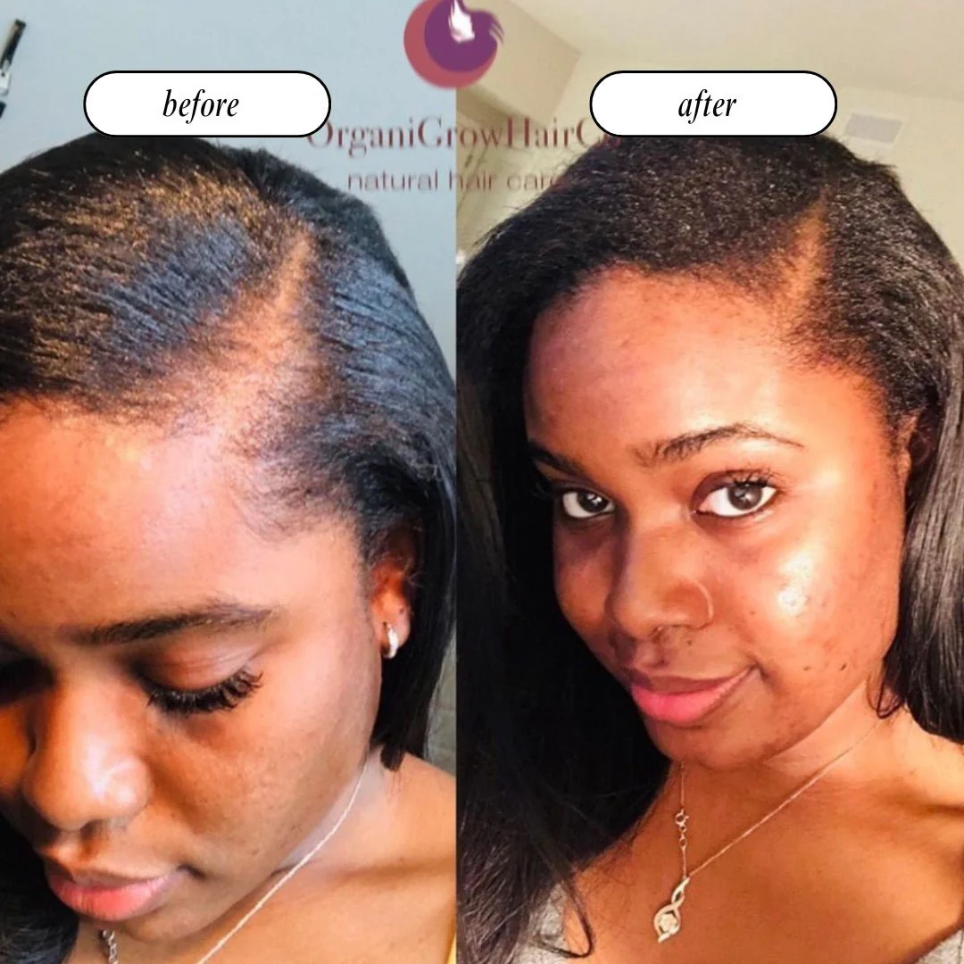 Stimulating Scalp Beverage - Medium Porosity with Black Seed Oil - Hair Growth Oil - Image 9