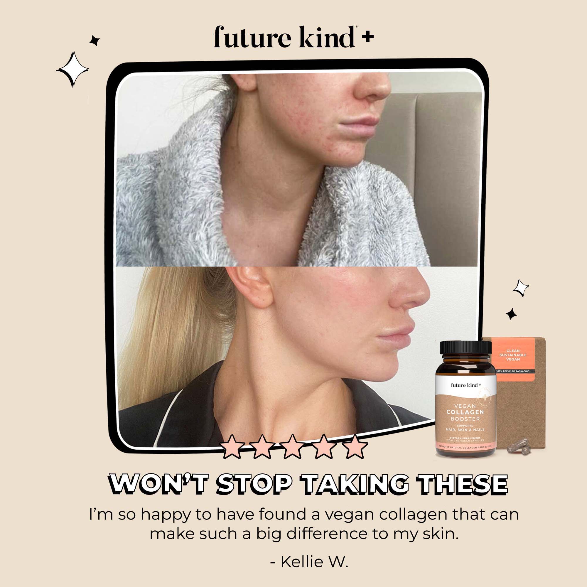 Vegan Collagen Booster Supplement - Image 9
