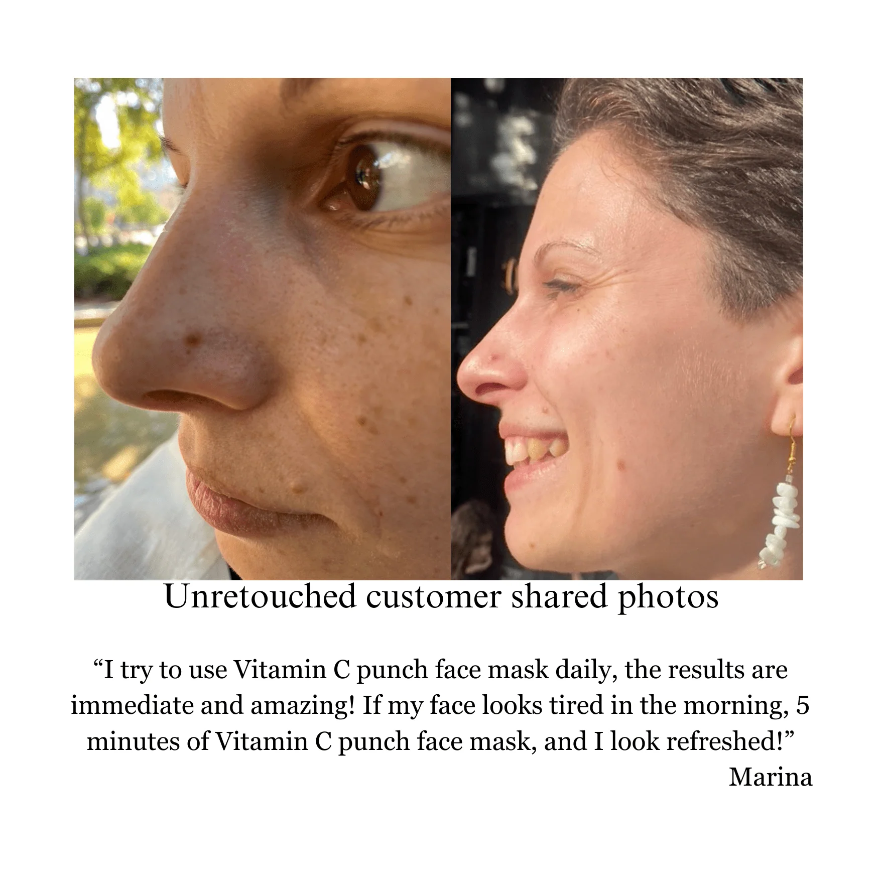 Vitamin C Punch,IMMEDIATE BRIGHTENING FACE MASK,  pH balanced formula - Image 3